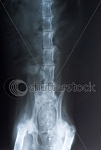 cat xray of abdomen, top view