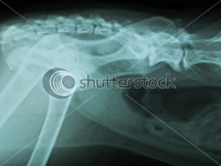 cat xray of pelvis, side view